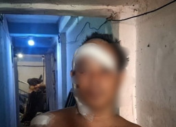 Khawatir Tak Bisa Bayar Biaya Pengobatan, Korban Pembacokan Pilih Pulang daripada Dirawat di RS